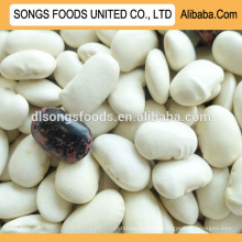 Manufacturing companies of types of kidney beans